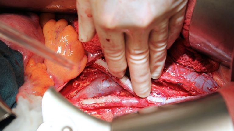 Golden Glow: [Country] Brings Home the Gold Medal in [Event]