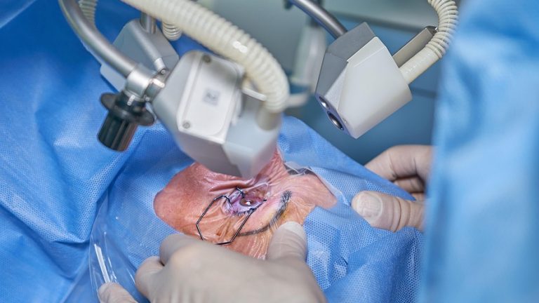 Revolutionizing the Cutting Edge: How Robotic Surgery is Changing the Face of Healthcare